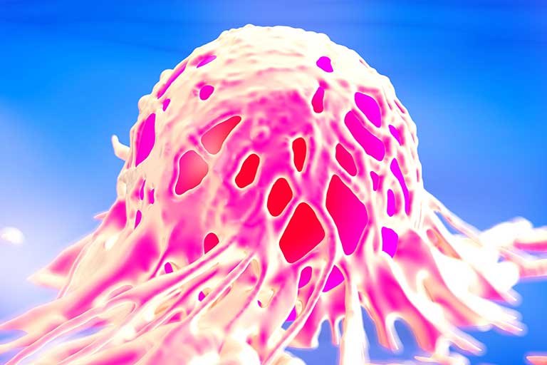 EVALUATION OF THE RISK OF TOXICITY TO FLUOROPYRIMIDINES (5FU)